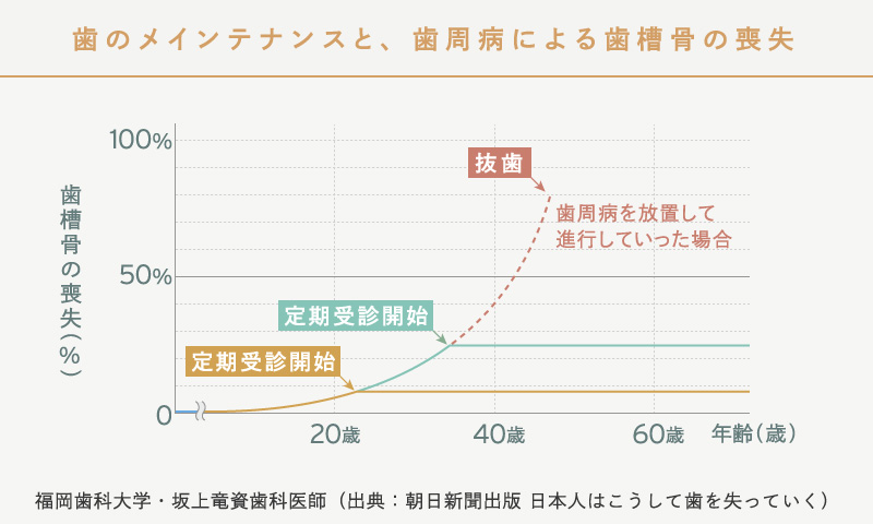 歯のメインテナンスと、歯周病による歯槽骨の喪失