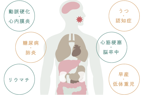 動脈硬化・心内膜炎、糖尿病・肺炎、リウマチ、うつ・認知症、心筋梗塞・脳卒中、早産・低体重児